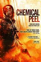 Poster of Chemical Peel
