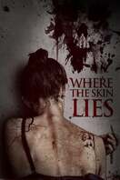 Poster of Where the Skin Lies