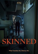 Poster of Skinned