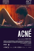 Poster of Acne