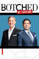 Poster of Botched By Nature